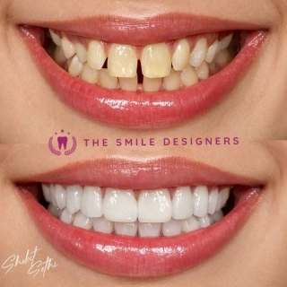 best dentist in zirakpur