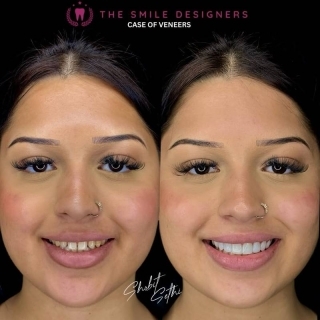 best dentist in mohali