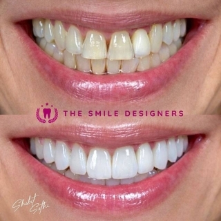 best dentist in derabasi