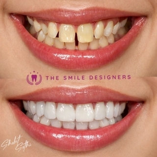 best dentist in zirakpur