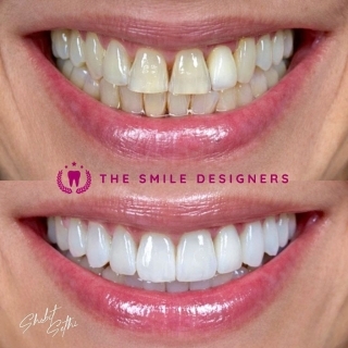 best dentist in derabasi