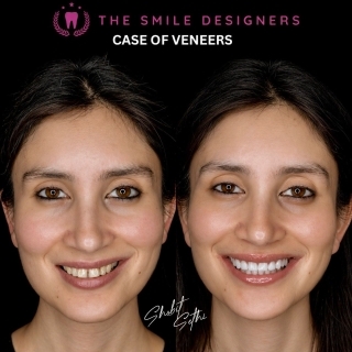 best dentist in chandigarh