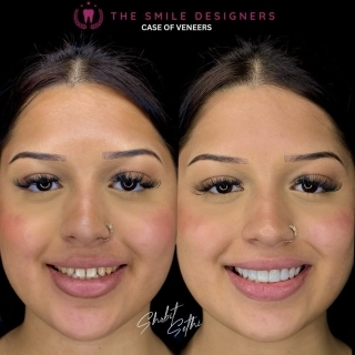 best dentist in mohali