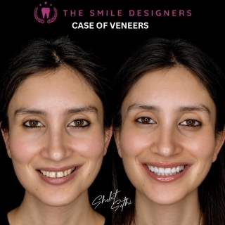 best dentist in chandigarh