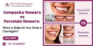 Composite Veneers vs Porcelain Veneers: Which is Better for Your Smile in Chandigarh?
