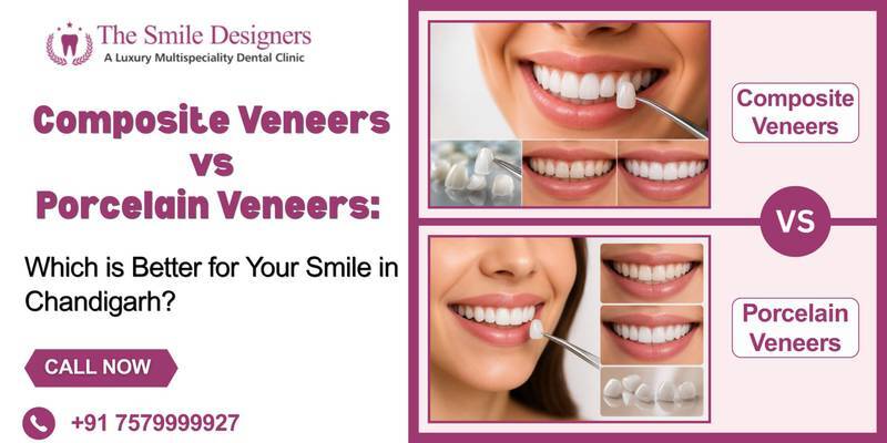 Composite Veneers vs Porcelain Veneers