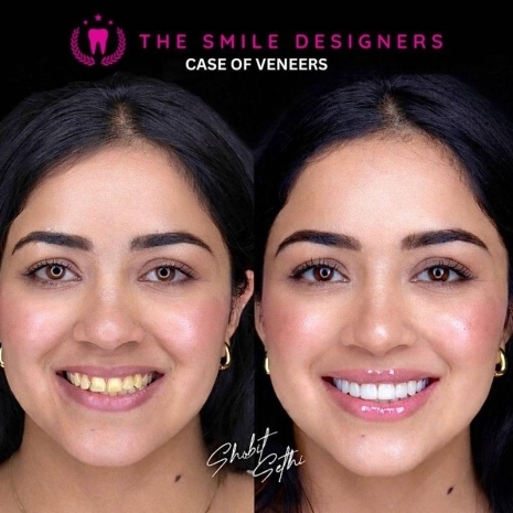 before-after-img-3