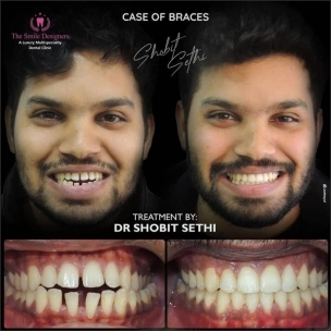 best dentist in chandigarh