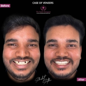 best dentist in Chandigarh