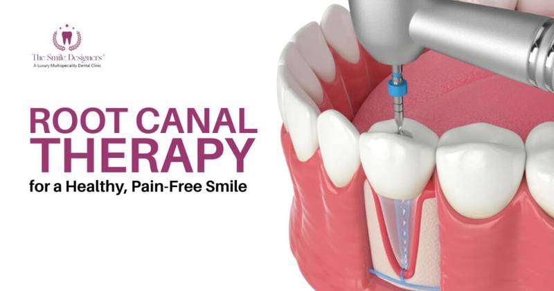 How to Find a Dentist in for Root Canal Treatment?