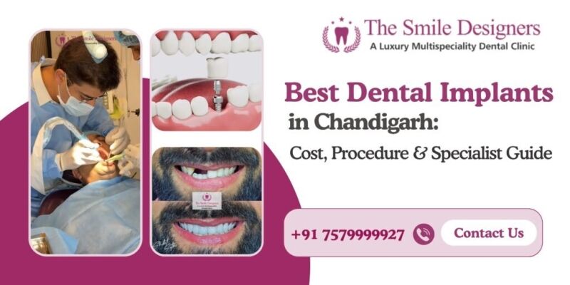 Best Dental Implants in Chandigarh: Cost, Procedure & Specialist Guide