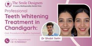 Professional Teeth Whitening Treatment in Chandigarh: Cost, Procedure & Benefits Explained