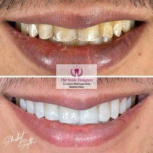 The Smile Designers