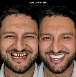 Best Dentist in Chandigarh Mohali - The Smile Designers