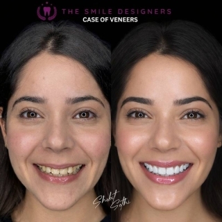 The best dentist in mohal