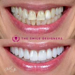 best dentist in derabasi