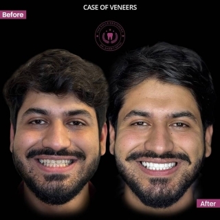 top best dentist in mohali