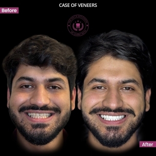 top best dentist in mohali