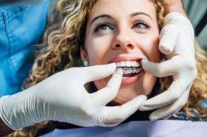 What Are The Primary Benefits of Invisalign Treatment ?