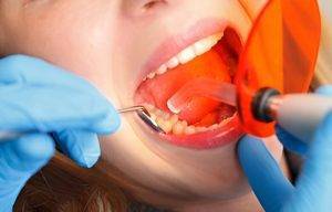 Exploring The Best Removable And Fixed Partial Dentures For Dental Restoration