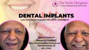 Which is The Best Low Cost Dental Implants Clinic in Chandigarh?