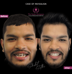 braces specialist in mohali