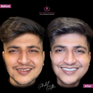best dentist in mohali