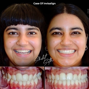 best dentist in Chandigarh