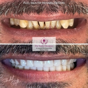 best dentist in Chandigarh