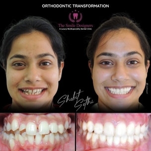 best dentist in Chandigarh