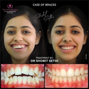 best dentist in mohali