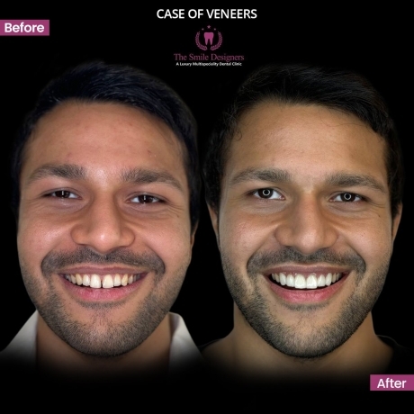 Dentisit in Mohali