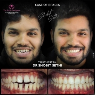best dentist in chandigarh
