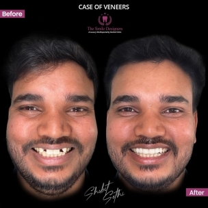 best dentist in Chandigarh