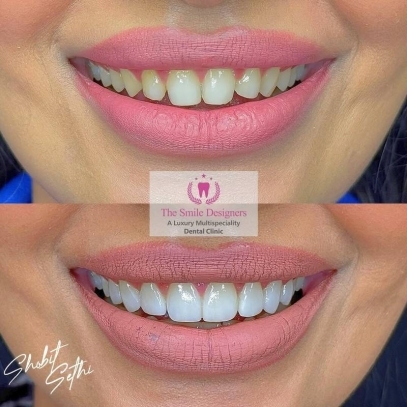 Best Dentist in Mohali