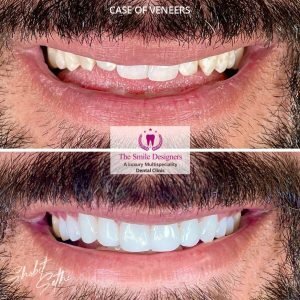The Smile Designers