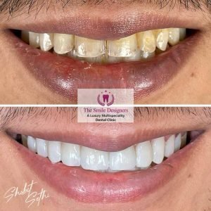 The Smile Designers