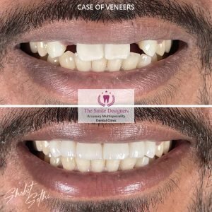 The Smile Designers