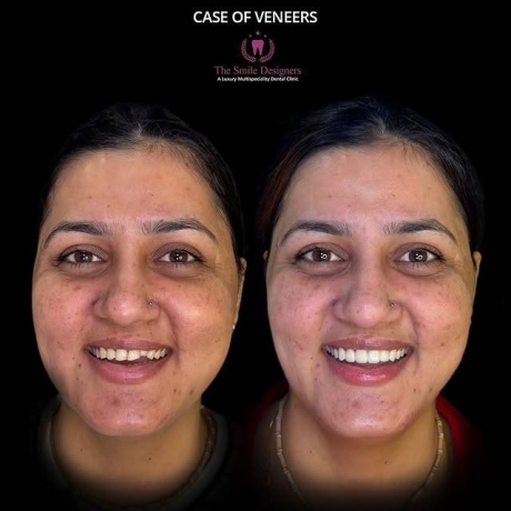 best dentist in chandigarh