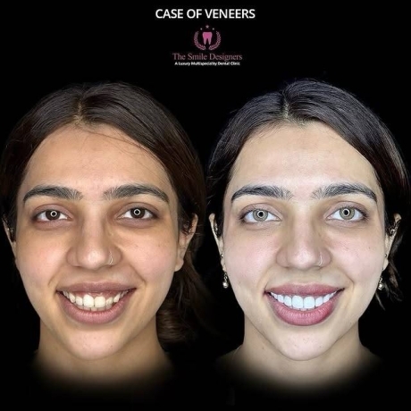 best dentist in chandigarh