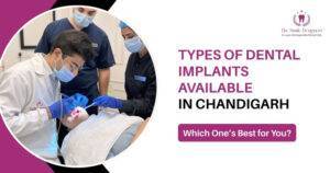 Types of Dental Implants Available in Chandigarh and Which One Is Right for You