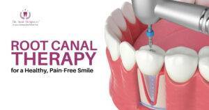 How to Find a Dentist in for Root Canal Treatment?