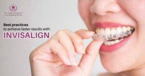 Tips for Faster Results With Invisalign Treatment in Mohali
