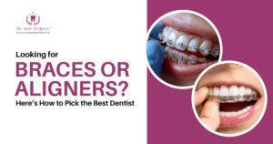 How to Choose the Dentist for Braces or Aligners?