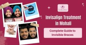Invisalign Treatment in Mohali: Complete Guide to Invisible Braces