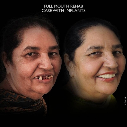 The Smile designers Mohali - happy clients