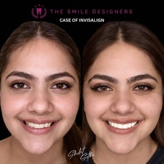 best dentist in mohali