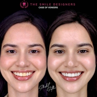 best dentist in kharar